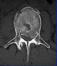 2004 08 17 10 45 58 706