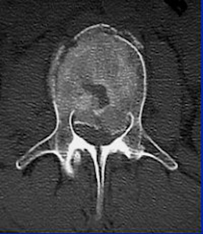 2004 08 17 10 45 58 706