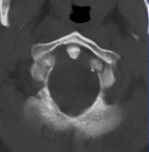 2004 08 17 11 01 32 706