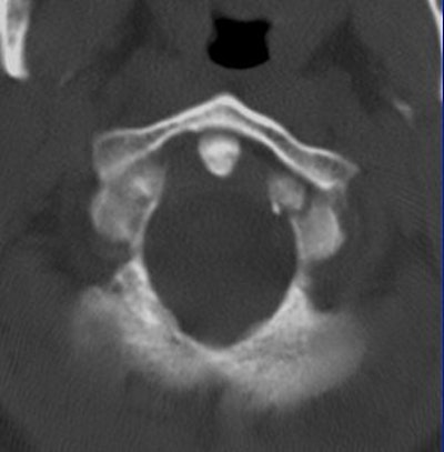 2004 08 17 11 01 32 706