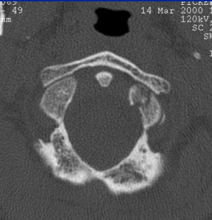 2004 08 17 11 01 58 706