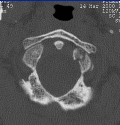 2004 08 17 11 01 58 706