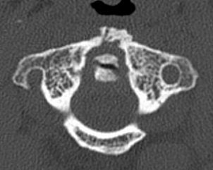 2004 08 17 11 05 54 706