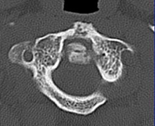 2004 08 17 11 06 16 706