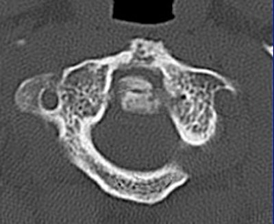 2004 08 17 11 06 16 706