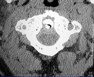 2004 08 17 11 09 22 706