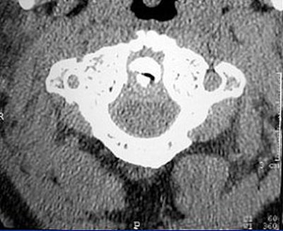 2004 08 17 11 09 22 706