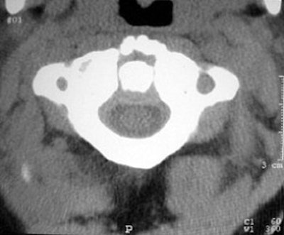 2004 08 17 11 09 38 706