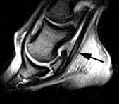 2004 08 20 15 28 30 706