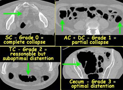 2004 08 20 16 12 03 706