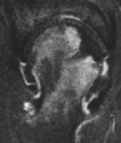 2004 08 25 11 49 37 706