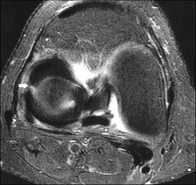 2004 08 27 11 36 46 706