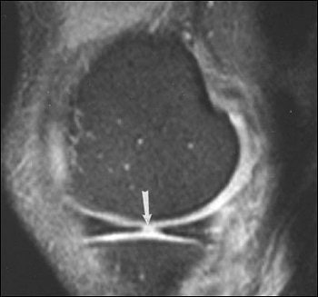 2004 08 27 11 45 35 706