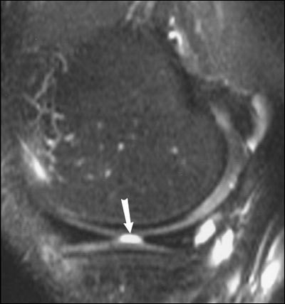 2004 08 27 11 46 16 706