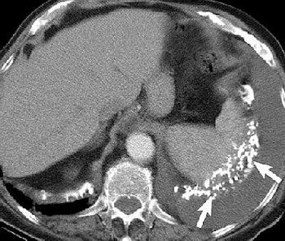 2004 09 03 15 01 16 706