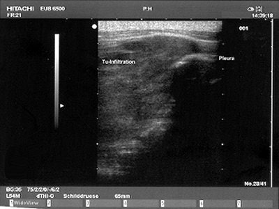 2004 09 03 15 07 34 706