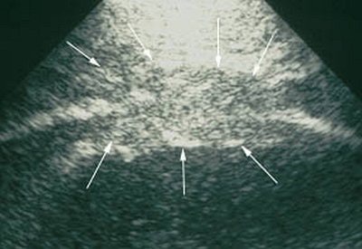 2004 09 03 15 09 31 706