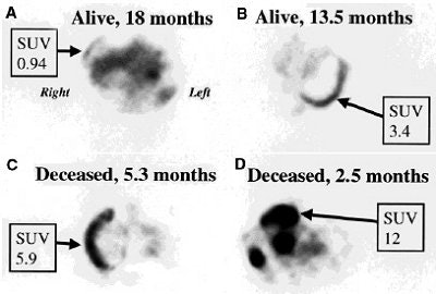 2004 09 03 15 11 22 706