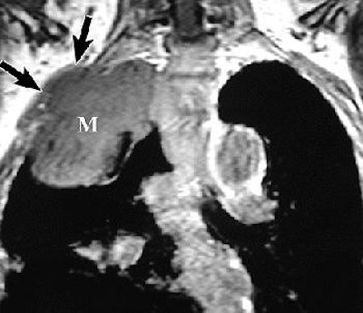 2004 09 03 15 13 26 706