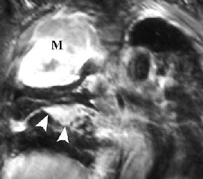 2004 09 03 15 13 49 706