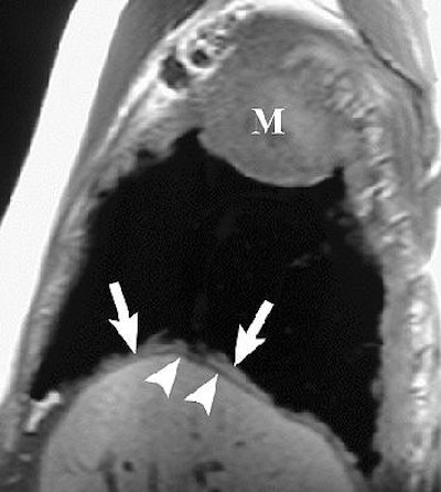 2004 09 03 15 16 08 706