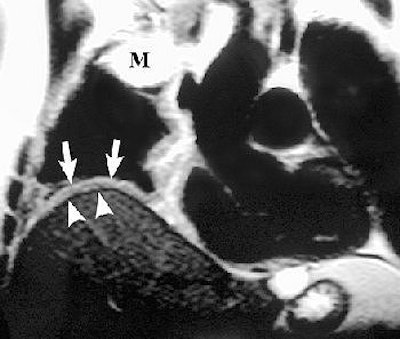 2004 09 03 15 16 36 706