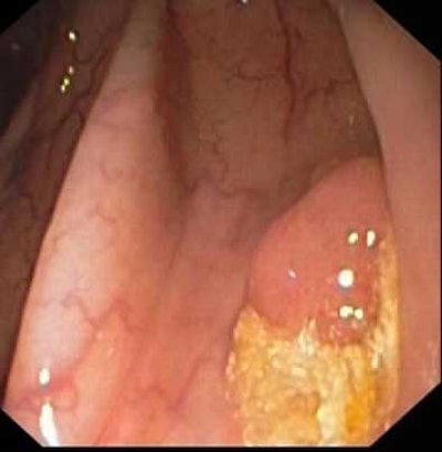 2004 09 07 15 12 47 706