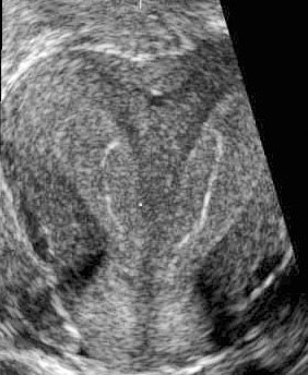 2004 09 08 15 59 40 706