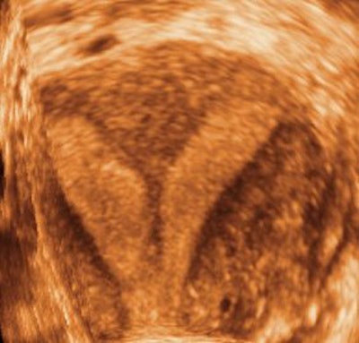 2004 09 08 16 00 34 706