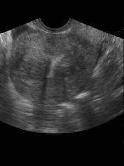 2004 09 08 16 01 13 706