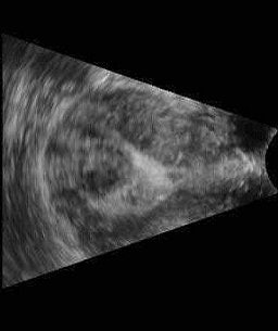 2004 09 08 16 01 43 706