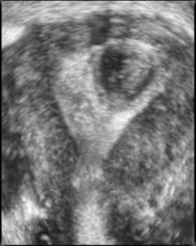 2004 09 08 16 02 20 706