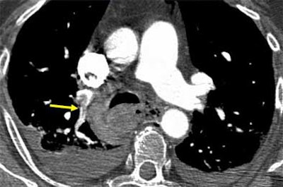 2004 09 09 15 07 50 706