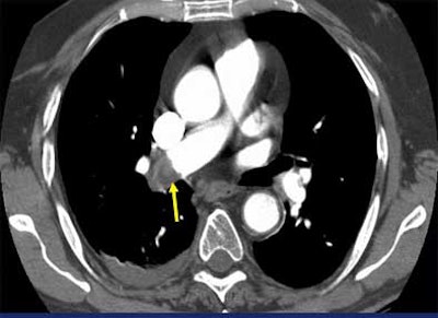 2004 09 09 15 11 28 706