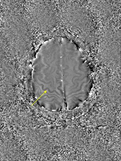 2004 09 14 14 48 04 706