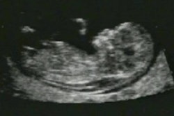 2004 10 01 16 15 54 706