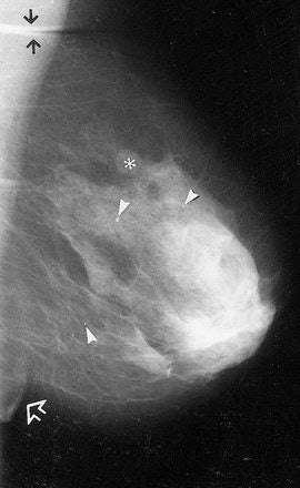 2004 10 04 15 40 39 706