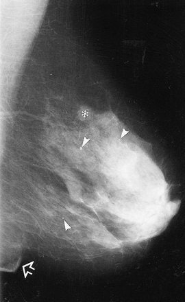 2004 10 04 15 56 42 706