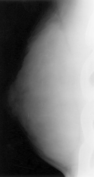 2004 10 04 16 03 16 706