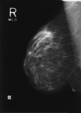 2004 10 04 16 17 43 706