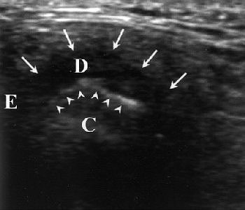 2004 10 08 14 05 22 706