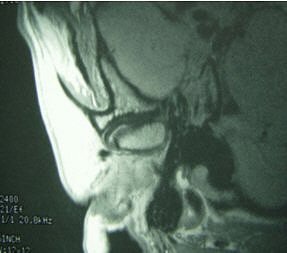 2004 10 08 14 14 52 706