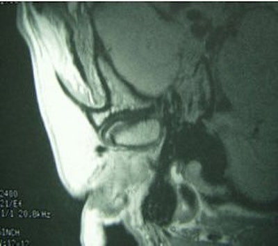 2004 10 08 14 14 52 706