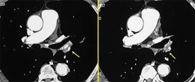 2004 10 08 15 48 08 706