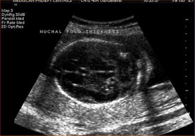 2004 10 25 11 34 25 706