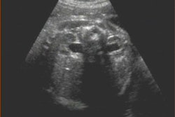 2004 10 25 11 34 43 706