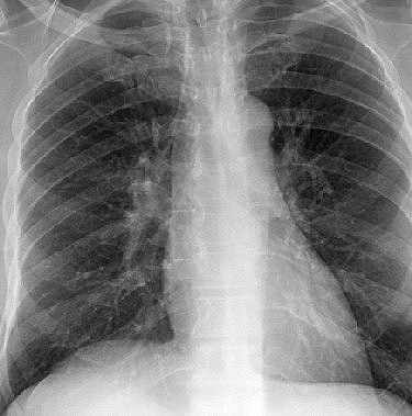 2004 10 27 10 56 57 706