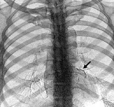 2004 10 27 10 57 20 706