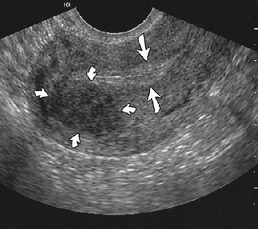 2004 10 29 17 13 35 706