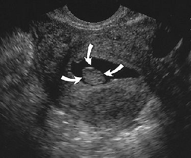 2004 10 29 17 13 53 706